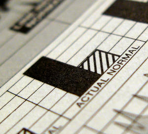 Actual is not normal (a tribute to Edward Tufte) Actual is not normal (a tribute to Edward Tufte)